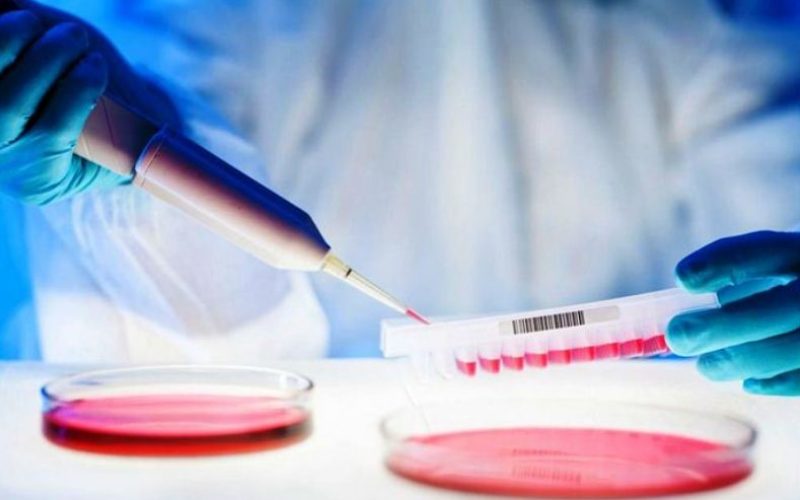 डीएनए जाँच के-कस्ता कुरामा गर्न सकिन्छ ? किन परीक्षण गराउने गर्छन ?