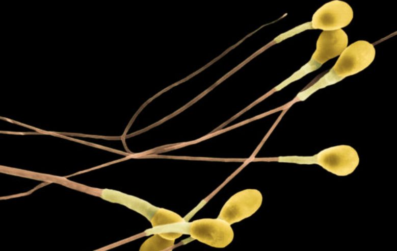 Gold in male sperm