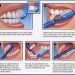 How-to-Brush-Teeth-Properly